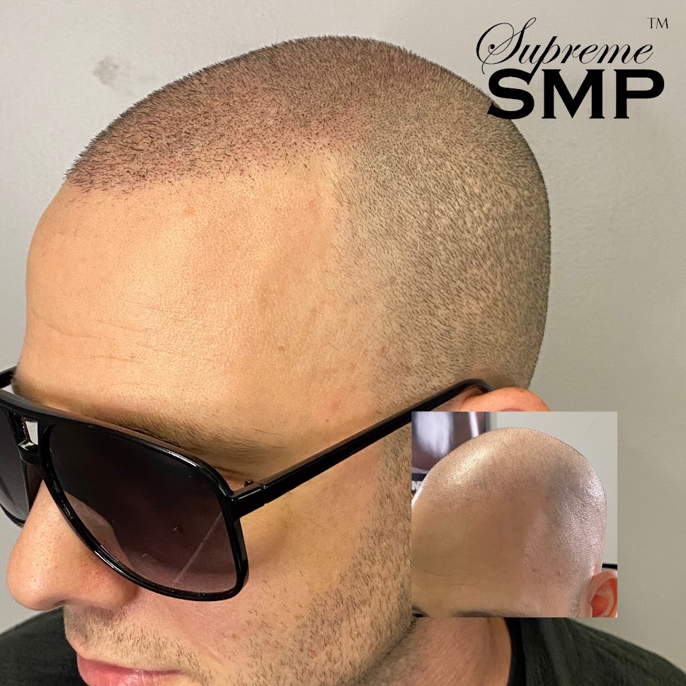 Img 6754: supreme smp
