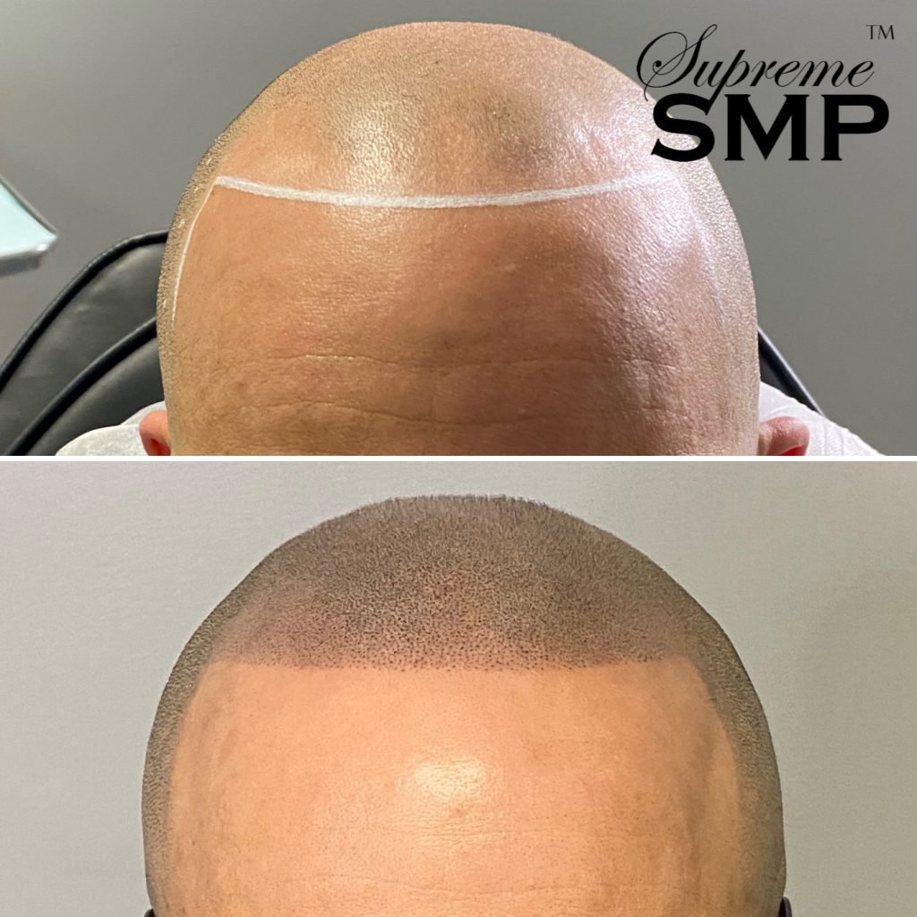Smptechnique: supreme smp Smptechnique: supreme smp