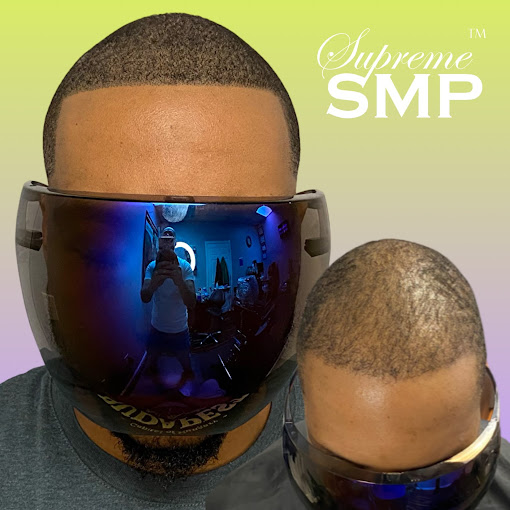Geo scalp micropigmentation concord results: supreme smp Geo scalp micropigmentation concord results: supreme smp