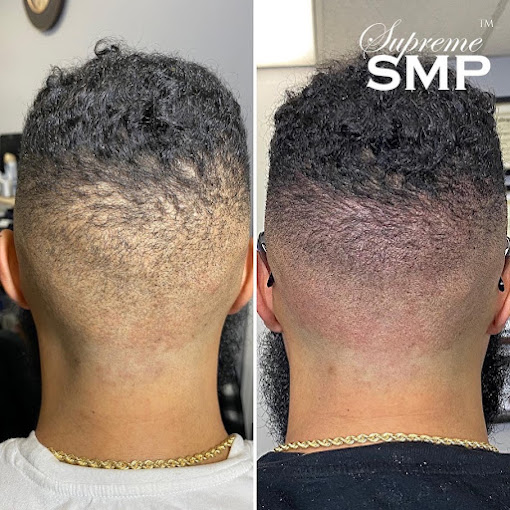 John scalp micropigmentation concord: supreme smp John scalp micropigmentation concord: supreme smp